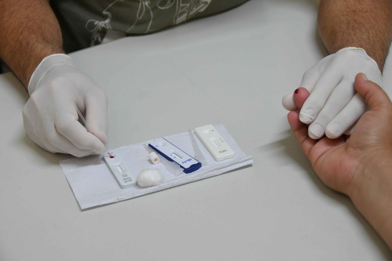 2025.11.25 HIV Aids Aumento número de casos © Leonardo Ariel (3) Teste rápido HIV.JPG