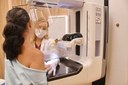 2026.02.19_ cancer de mama_mamografia © Roberto Guedes (99).JPG