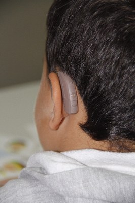 O aparelho retroauricular, que é utilizado para casos severos, fica atrás da orelha